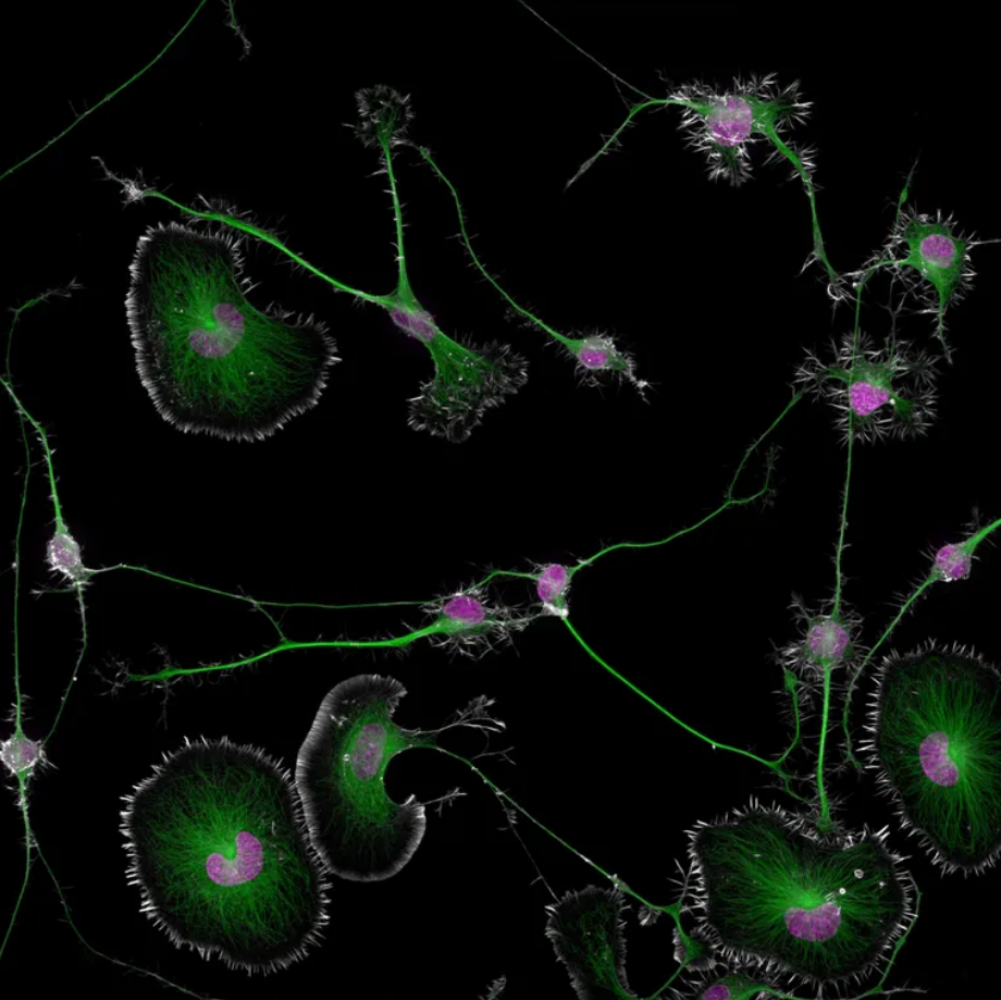 Imagen de células tumorales diferenciadas de cerebro de ratón